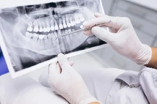 Básico em Endodontia